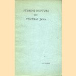 Uterine Rupture in Central java
Arie Andries Haspels
€ 6,00 Uterine Rupture in Central java
Arie Andries Haspels
€ 6,00