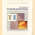 An Atlas of Contraception
Pramilla Senanayake e.a.
€ 5,00