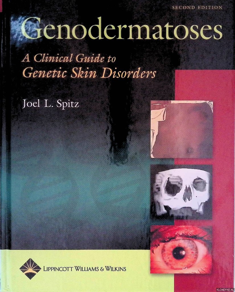 Spitz, Joel L. - Genodermatoses: A Clinical Guide to Genetic Skin Disorders - Second edition